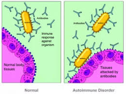 Sindrome Pandas Pediatric Autoimmune Neurpsychiatric disorder